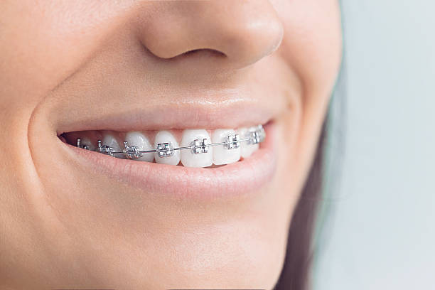 Full Mouth Reconstruction in Harbor, OR